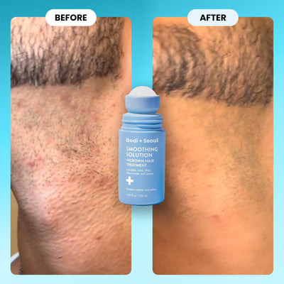 Ingrown & Razor Bump Solution AHA/BHA/PHA