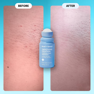 Ingrown & Razor Bump Solution AHA/BHA/PHA