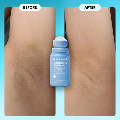 Ingrown & Razor Bump Solution AHA/BHA/PHA